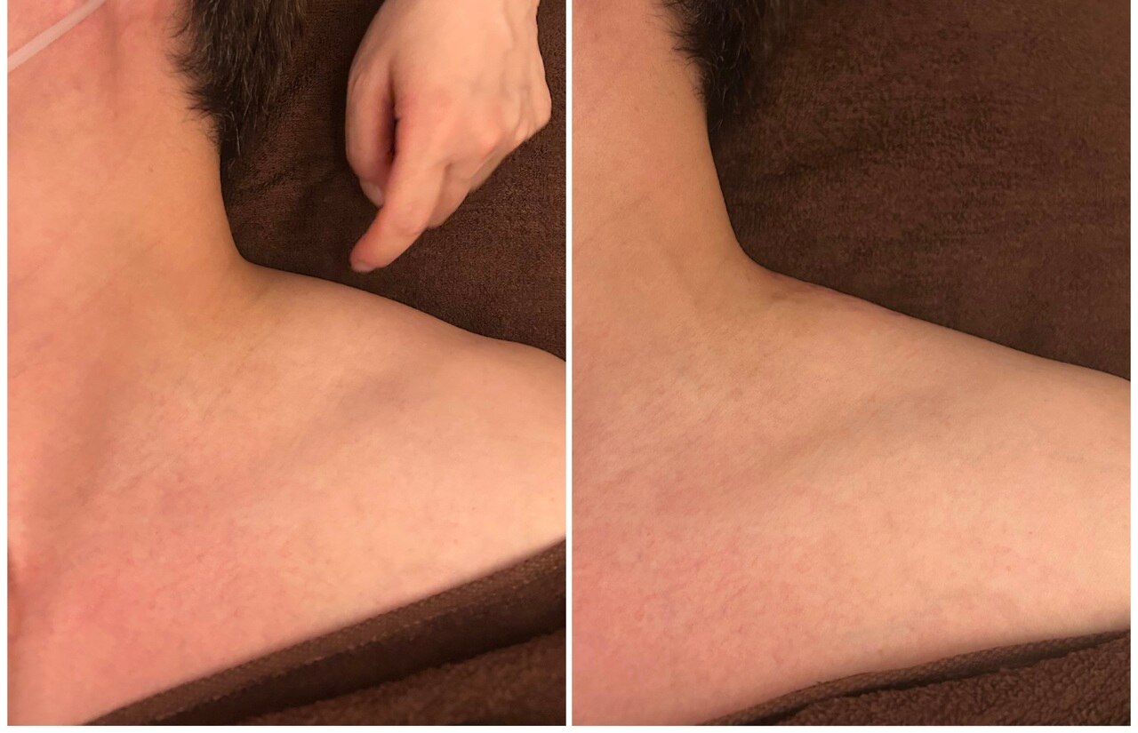 肩のコリを取って首を長く、小顔効果